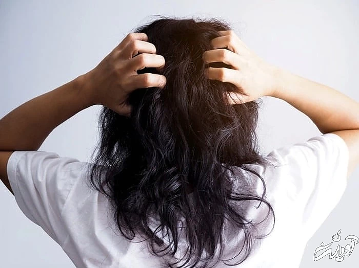 روغن زردآلو برای مشکلات پوست سر مشکلات پوست سر